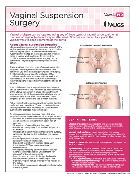 Vaginal_Suspension_Surgery