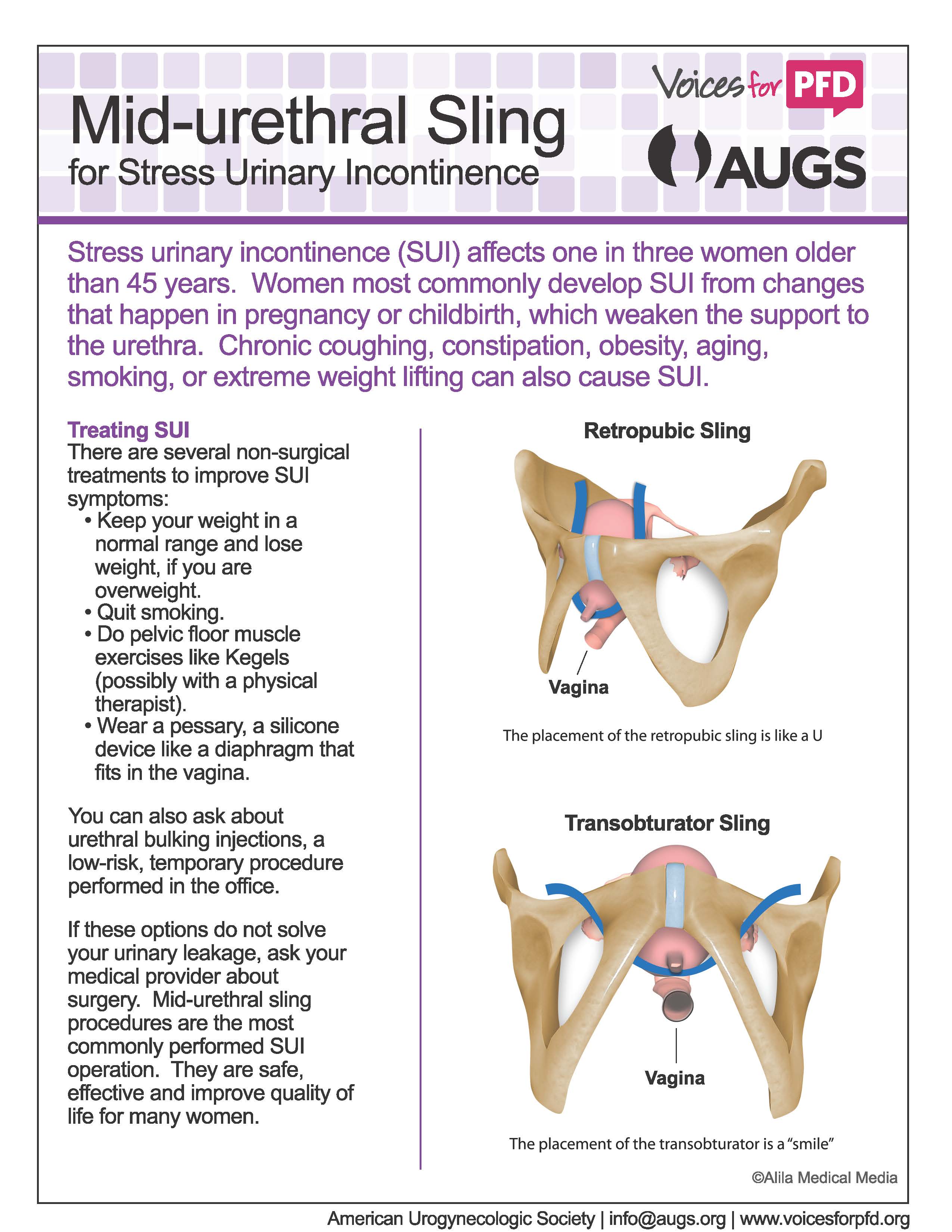 Mid-Urethral_Sling_Page_1