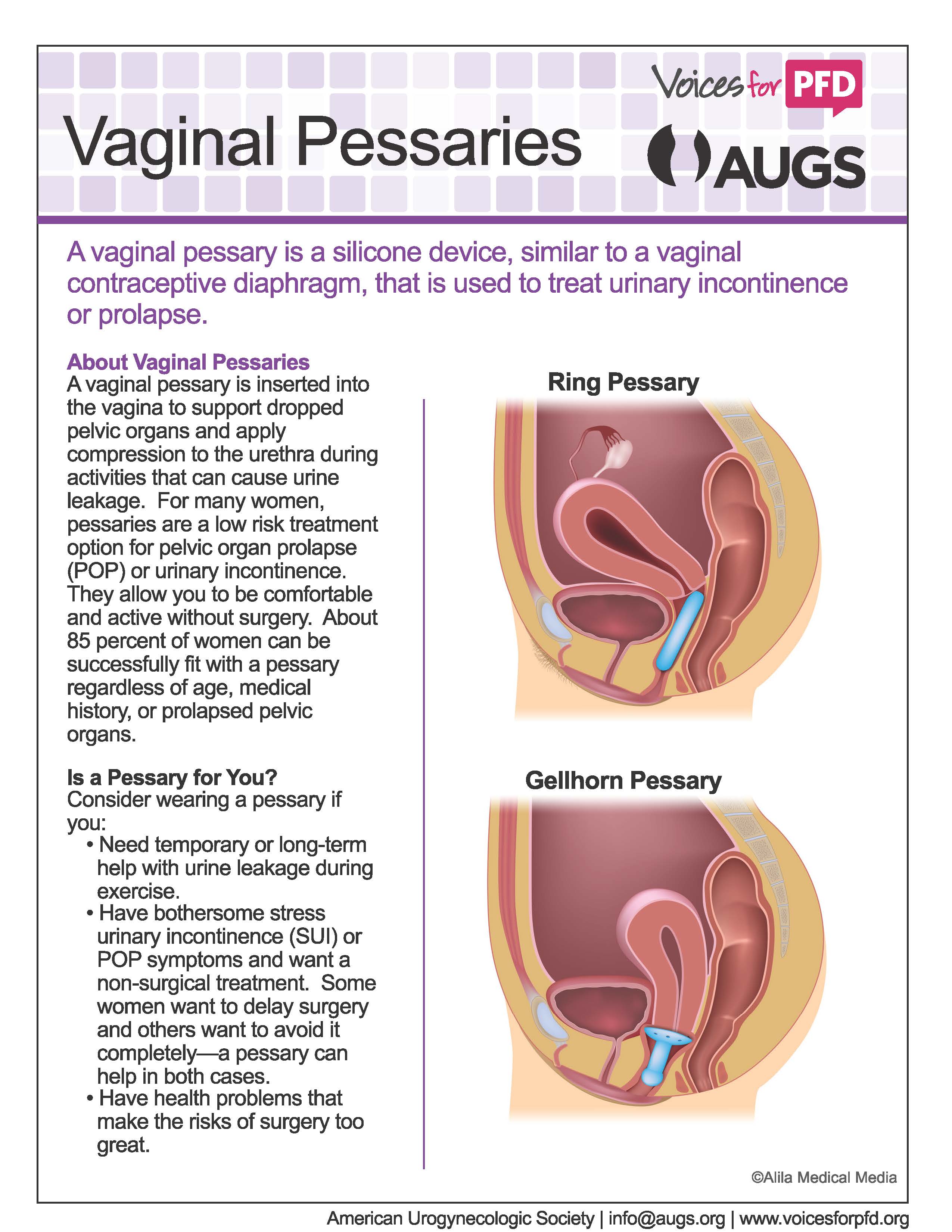 Vaginal_Pessaries_Page_1